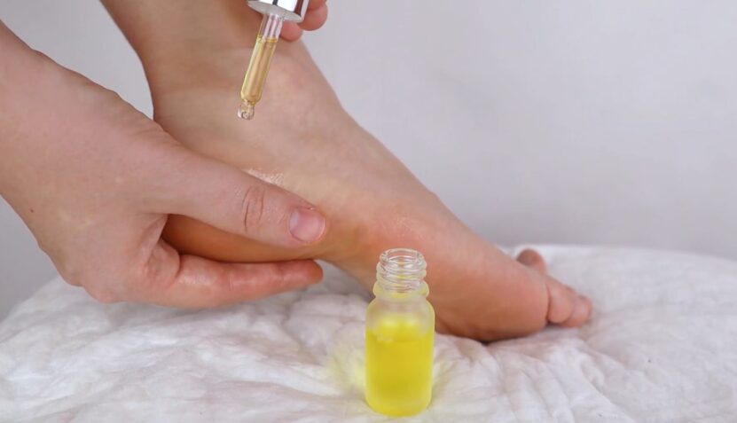 Moisturizing dry cracked feet